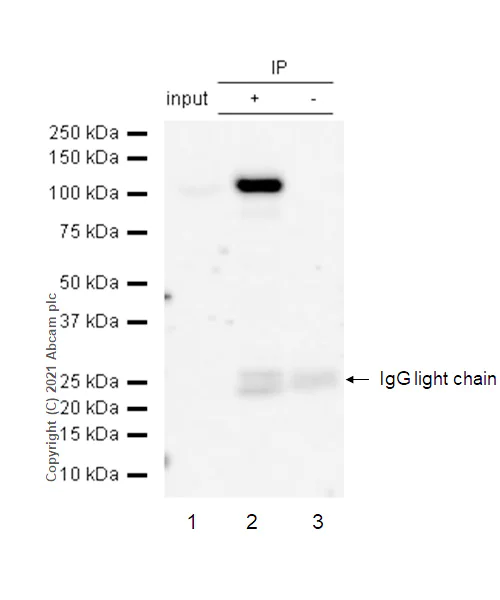 Immunoprecipitation - Anti-PRKD2 (phospho S876) antibody [EP1496Y] - BSA and Azide free (AB246493)