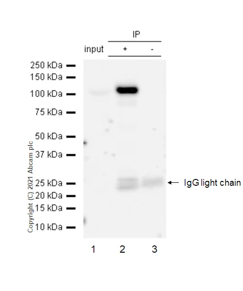 Immunoprecipitation - Anti-PRKD2 (phospho S876) antibody [EP1496Y] - BSA and Azide free (AB246493)