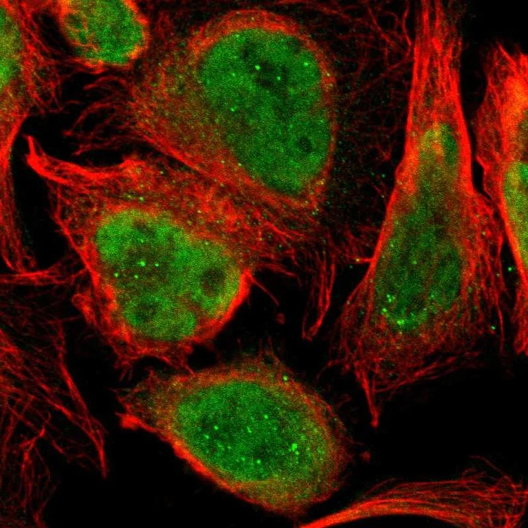 Immunocytochemistry/ Immunofluorescence - Anti-PRKRIR antibody (AB246889)