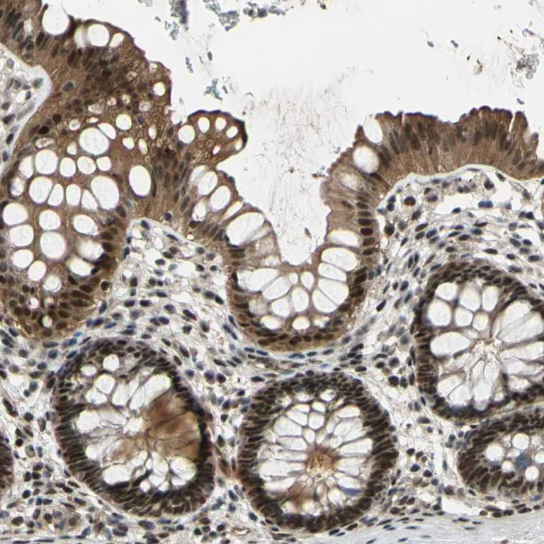 Immunohistochemistry (Formalin/PFA-fixed paraffin-embedded sections) - Anti-PRKRIR antibody (AB246889)