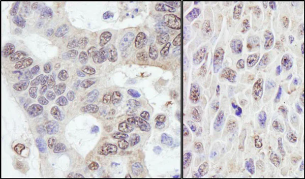 Immunohistochemistry (Formalin/PFA-fixed paraffin-embedded sections) - Anti-PRKRIR antibody (AB70334)