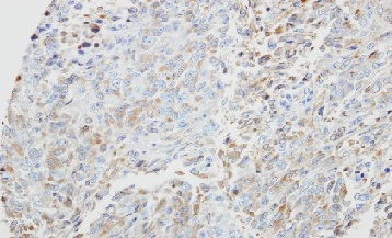 Immunohistochemistry (Formalin/PFA-fixed paraffin-embedded sections) - Anti-PRKX antibody (AB154739)