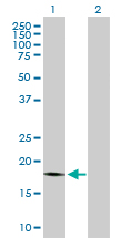 Western blot - Anti-PRL-1 antibody (AB168643)