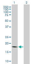 Western blot - Anti-PRL-1 antibody (AB168643)