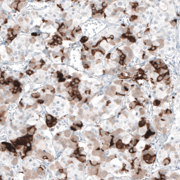 Immunohistochemistry (Formalin/PFA-fixed paraffin-embedded sections) - Anti-PRL Antibody [CL6550] (AB327122)