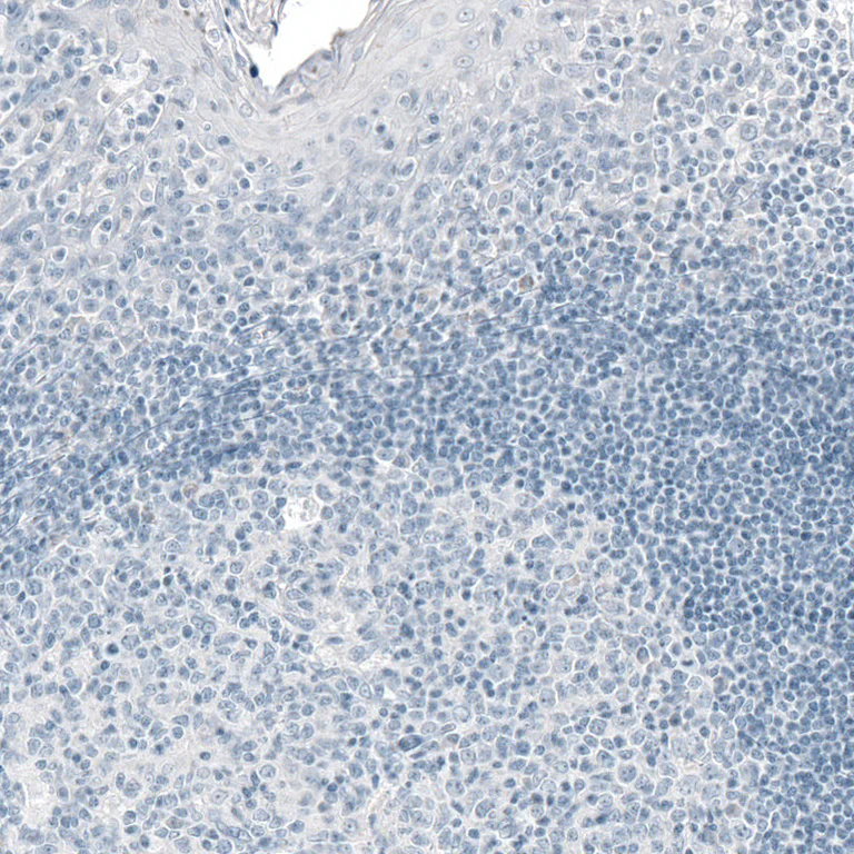 Immunohistochemistry (Formalin/PFA-fixed paraffin-embedded sections) - Anti-PRL Antibody [CL6550] (AB327122)