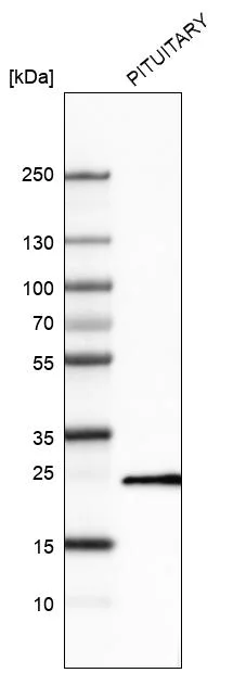 Western blot - Anti-PRL Antibody [CL6550] (AB327122)
