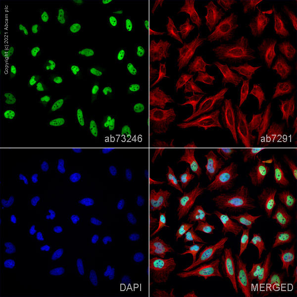 Immunocytochemistry - Anti-PRMT1 antibody (AB73246)