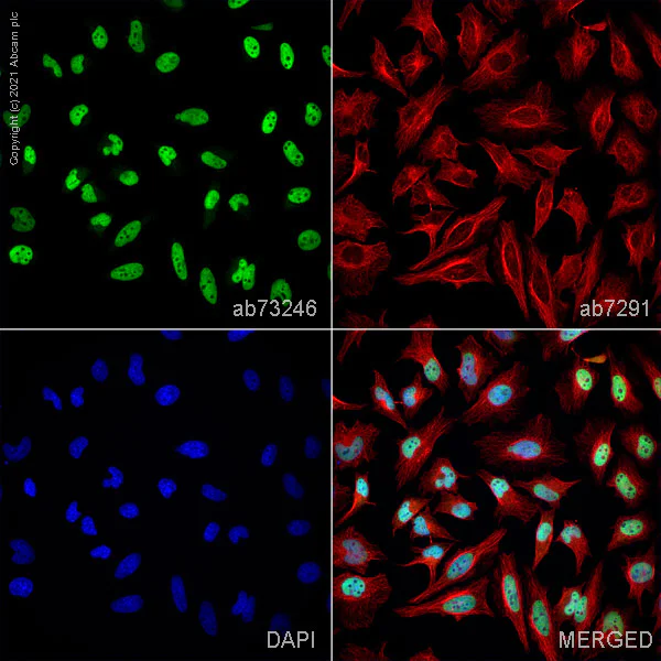 Immunocytochemistry - Anti-PRMT1 antibody (AB73246)