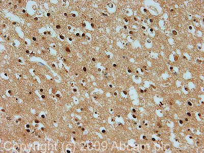 Immunohistochemistry (Formalin/PFA-fixed paraffin-embedded sections) - Anti-PRMT1 antibody (AB73246)