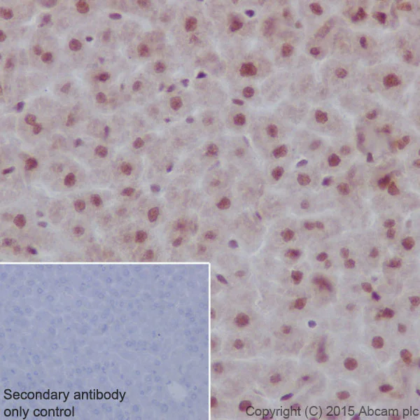 Immunohistochemistry (Formalin/PFA-fixed paraffin-embedded sections) - Anti-PRMT1 antibody [EPR18344] (AB190892)