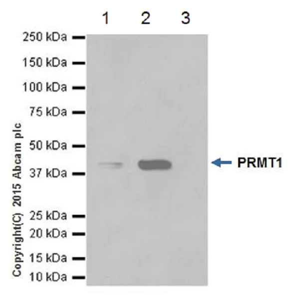 Immunoprecipitation - Anti-PRMT1 antibody [EPR18344] (AB190892)