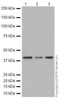 Western blot - Anti-PRMT1 antibody [EPR18344] (AB190892)