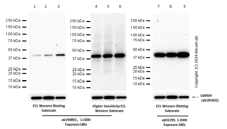 Western blot - Anti-PRMT1 antibody [EPR18344] (AB190892)