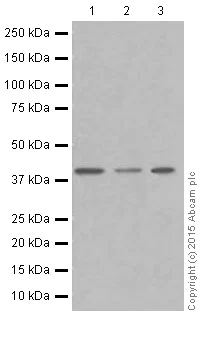 Western blot - Anti-PRMT1 antibody [EPR18344] (AB190892)
