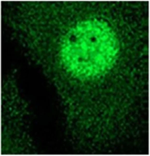 Immunocytochemistry/ Immunofluorescence - Anti-PRMT1 antibody [MAT-B12] (AB7027)