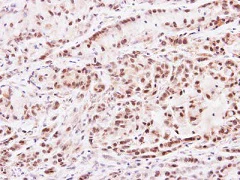 Immunohistochemistry (Formalin/PFA-fixed paraffin-embedded sections) - Anti-PRMT2/HMT1 antibody (AB154154)