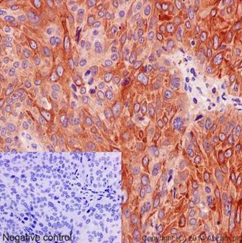 Immunohistochemistry (Formalin/PFA-fixed paraffin-embedded sections) - Anti-PRMT3 antibody [EPR13279] - BSA and Azide free (AB240322)