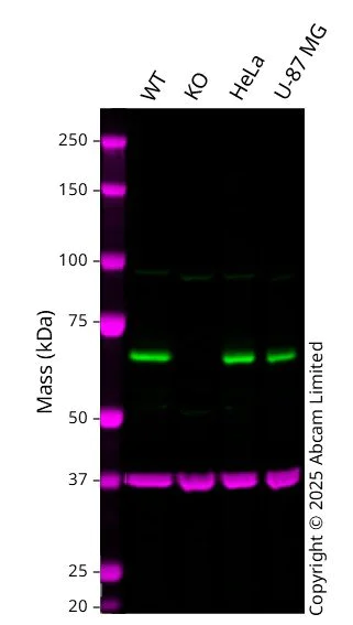 Western blot - Anti-PRMT3 antibody [EPR13279] - BSA and Azide free (AB240322)
