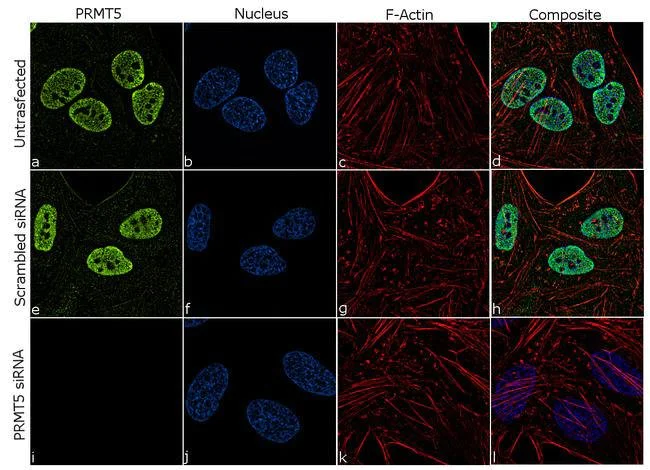 Immunocytochemistry - Anti-PRMT5 antibody [3HCLC] (AB277792)