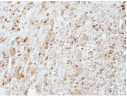 Immunohistochemistry (Formalin/PFA-fixed paraffin-embedded sections) - Anti-PRMT5 antibody (AB151321)