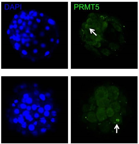 Immunocytochemistry/ Immunofluorescence - Anti-PRMT5 antibody [EPR5772] (AB109451), expandable thumbnail