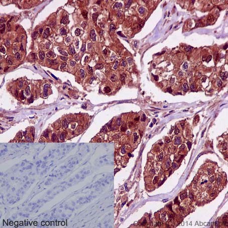 Immunohistochemistry (Formalin/PFA-fixed paraffin-embedded sections) - Anti-PRMT5 antibody [EPR5772] (ab109451), expandable thumbnail
