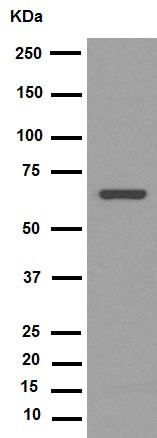 Western blot - Anti-PRMT5 antibody [EPR5772] (AB109451), expandable thumbnail