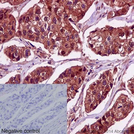 Immunohistochemistry (Formalin/PFA-fixed paraffin-embedded sections) - Anti-PRMT5 antibody [EPR5772] - BSA and Azide free (AB215364)