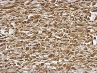 Immunohistochemistry (Formalin/PFA-fixed paraffin-embedded sections) - Anti-PRMT7 antibody (AB126965)