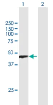 Western blot - Anti-PRMT8 antibody (AB168134)