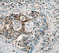 Immunohistochemistry (Formalin/PFA-fixed paraffin-embedded sections) - Anti-pro Caspase-3 antibody [E61] - BSA and Azide free (AB183179)
