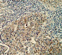 Immunohistochemistry (Formalin/PFA-fixed paraffin-embedded sections) - Anti-pro Caspase-7 antibody [Y33] (AB32067), expandable thumbnail