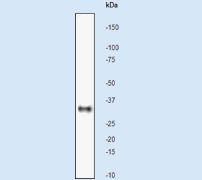 Western blot - Anti-pro Caspase-7 antibody [Y33] (AB32067), expandable thumbnail