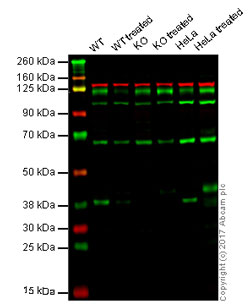 Western blot - Anti-pro Caspase-7 antibody [Y33] (AB32067), expandable thumbnail