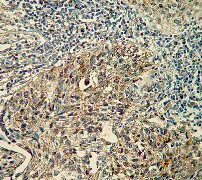 Immunohistochemistry (Formalin/PFA-fixed paraffin-embedded sections) - Anti-pro Caspase-7 antibody [Y33] - BSA and Azide free (AB247219)
