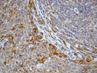 Immunohistochemistry (Formalin/PFA-fixed paraffin-embedded sections) - Anti-Pro Caspase-8 antibody [EPR162] - BSA and Azide free (AB208774)