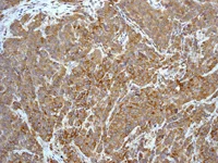 Immunohistochemistry (Formalin/PFA-fixed paraffin-embedded sections) - Anti-Pro Caspase-8 antibody [EPR162] - BSA and Azide free (AB208774)