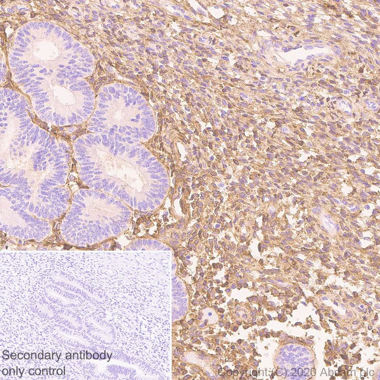 Immunohistochemistry (Formalin/PFA-fixed paraffin-embedded sections) - Anti-Pro-Collagen III alpha 1 antibody [EPR24255-13] (AB279338)