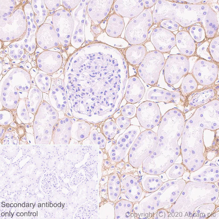 Immunohistochemistry (Formalin/PFA-fixed paraffin-embedded sections) - Anti-Pro-Collagen III alpha 1 antibody [EPR24255-13] (AB279338)