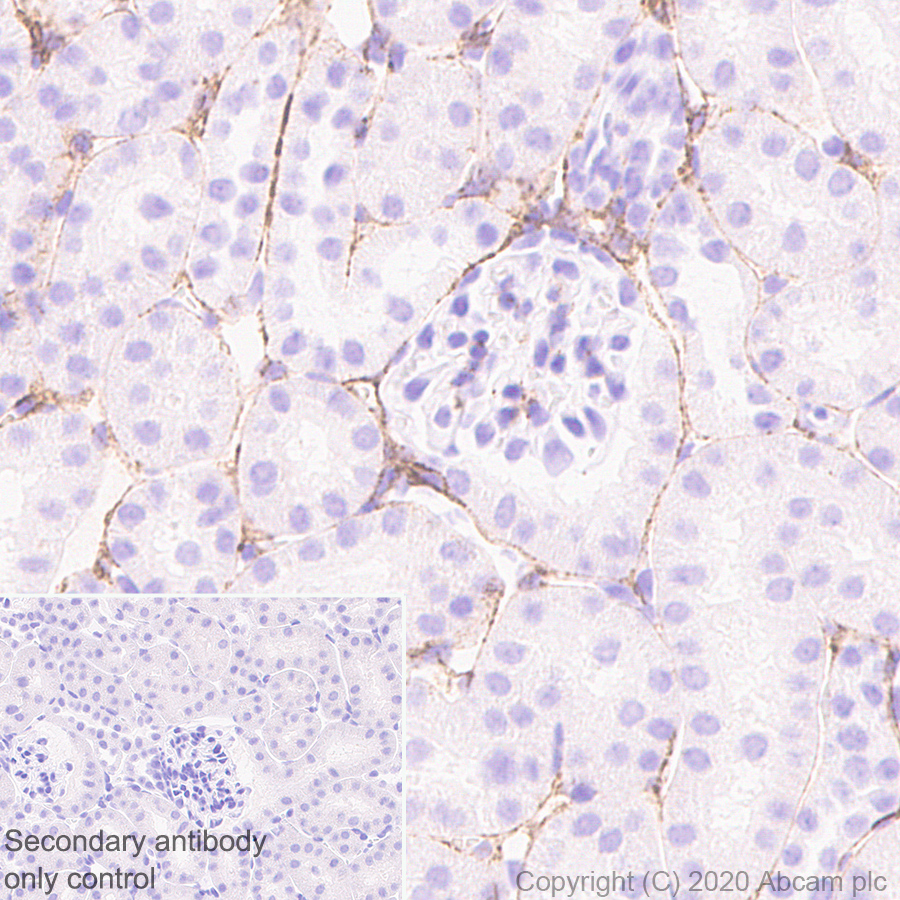 Immunohistochemistry (Formalin/PFA-fixed paraffin-embedded sections) - Anti-Pro-Collagen III alpha 1 antibody [EPR24257-57] - BSA and Azide free (AB278082), expandable thumbnail