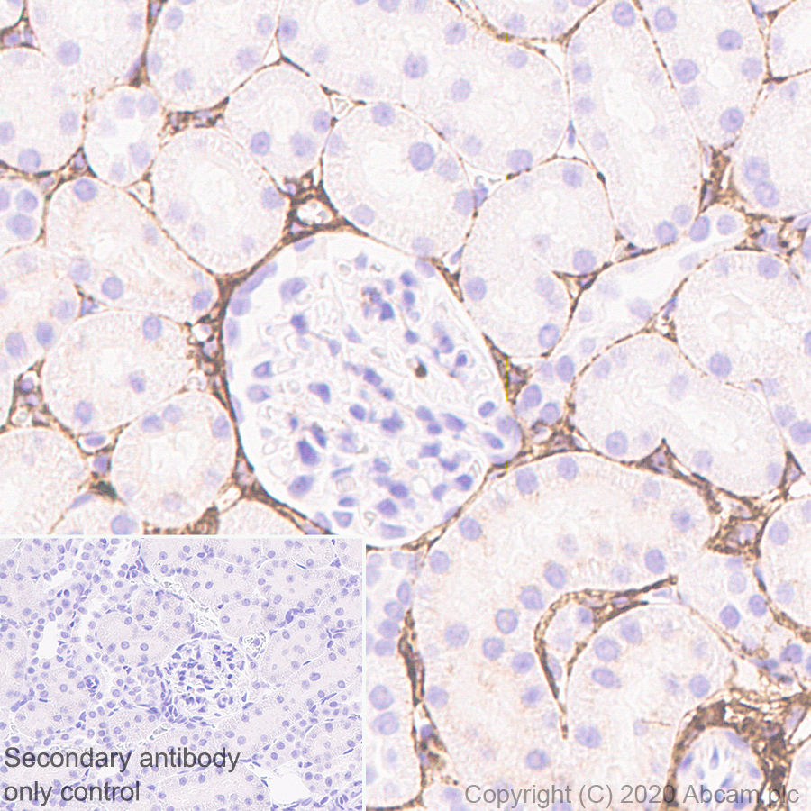 Immunohistochemistry (Formalin/PFA-fixed paraffin-embedded sections) - Anti-Pro-Collagen III alpha 1 antibody [EPR24257-57] - BSA and Azide free (AB278082), expandable thumbnail