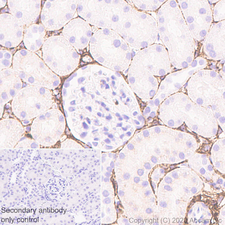 Immunohistochemistry (Formalin/PFA-fixed paraffin-embedded sections) - Anti-Pro-Collagen III alpha 1 antibody [EPR24257-57] - BSA and Azide free (AB278082)