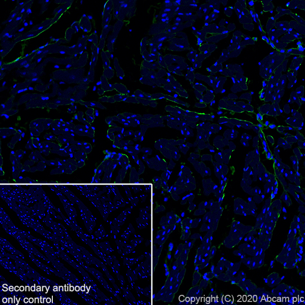 Immunohistochemistry (Frozen sections) - Anti-Pro-Collagen III alpha 1 antibody [EPR24257-57] - BSA and Azide free (AB278082), expandable thumbnail