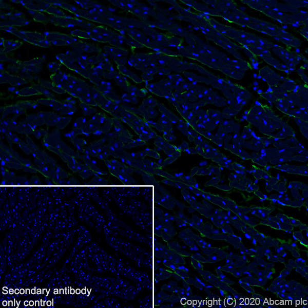 Immunohistochemistry (Frozen sections) - Anti-Pro-Collagen III alpha 1 antibody [EPR24257-57] - BSA and Azide free (AB278082), expandable thumbnail