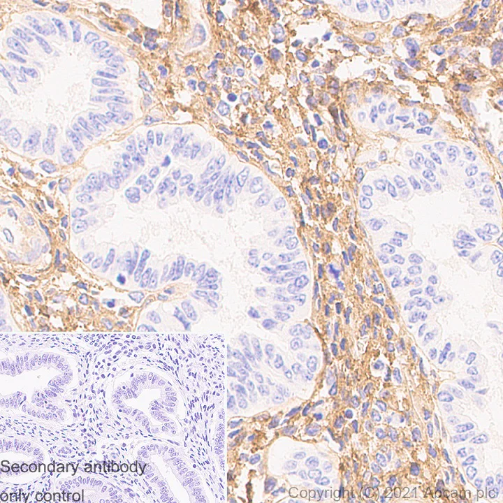 Immunohistochemistry (Formalin/PFA-fixed paraffin-embedded sections) - Anti-Pro-Collagen III alpha 1 antibody [RM1028] (AB283694)