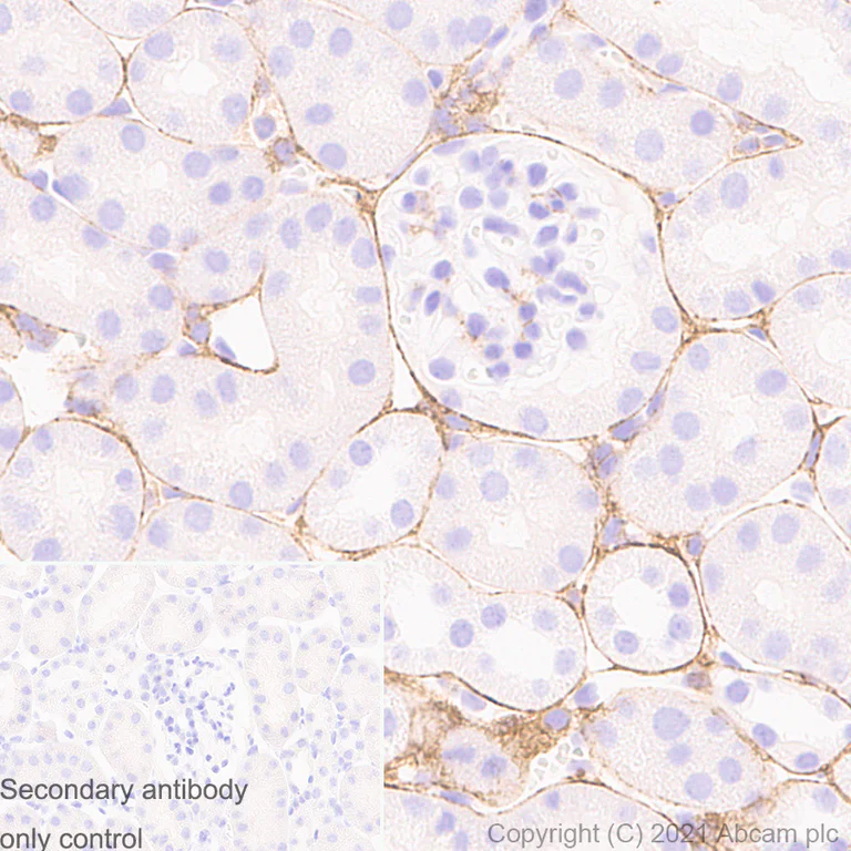 Immunohistochemistry (Formalin/PFA-fixed paraffin-embedded sections) - Anti-Pro-Collagen III alpha 1 antibody [RM1028] (AB283694)