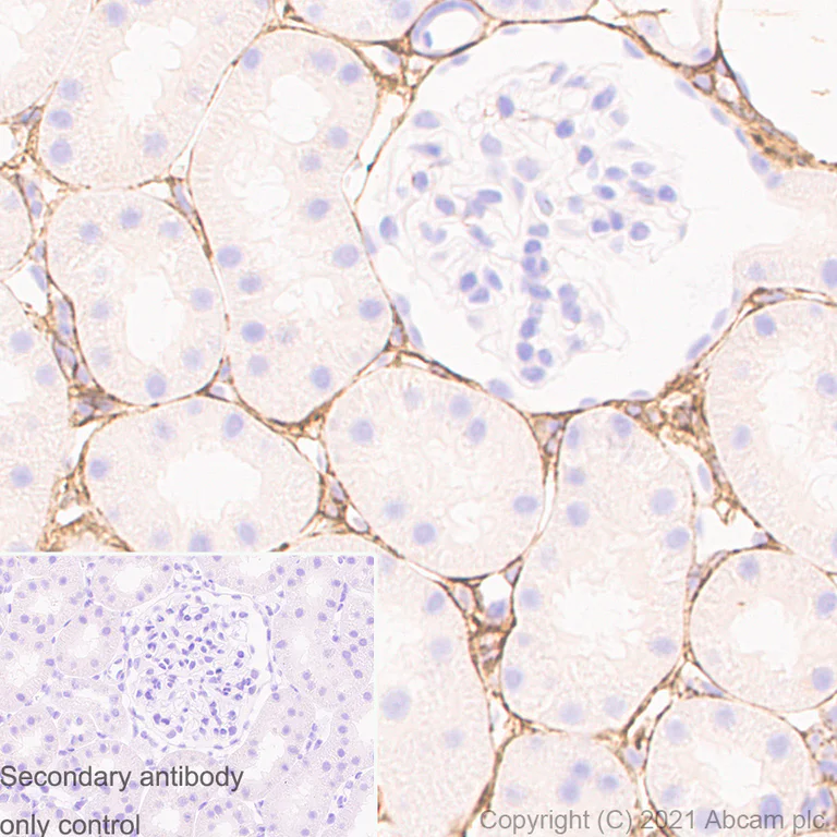 Immunohistochemistry (Formalin/PFA-fixed paraffin-embedded sections) - Anti-Pro-Collagen III alpha 1 antibody [RM1028] (AB283694)