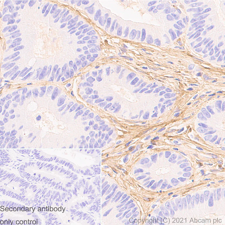 Immunohistochemistry (Formalin/PFA-fixed paraffin-embedded sections) - Anti-Pro-Collagen III alpha 1 antibody [RM1028] (AB283694)