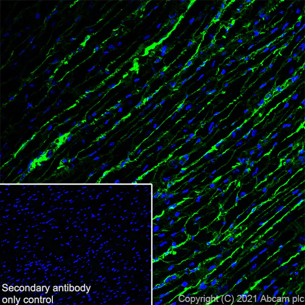 Immunohistochemistry (Frozen sections) - Anti-Pro-Collagen III alpha 1 antibody [RM1028] (AB283694)